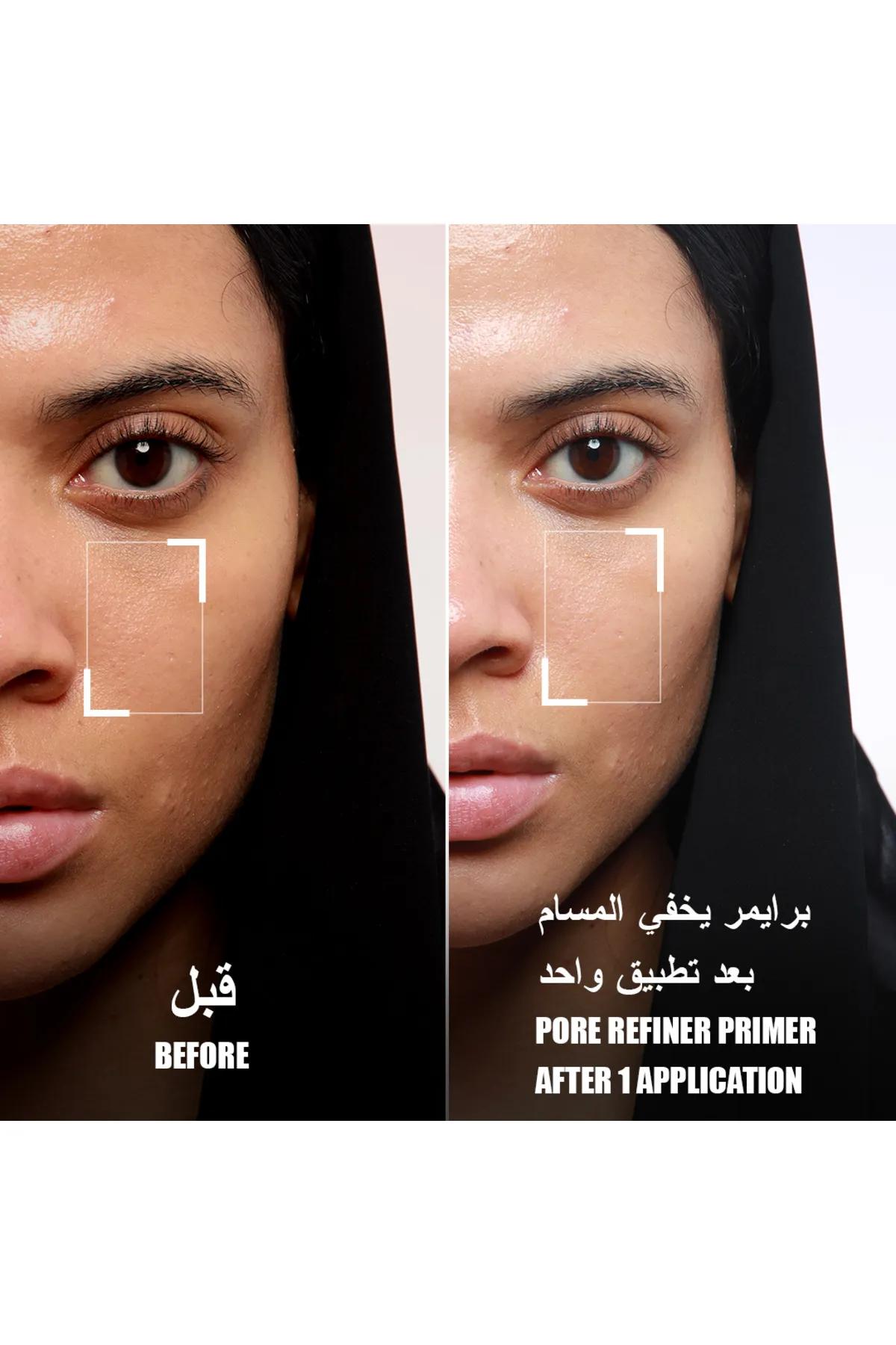 Layered Pore Refine-Beige
